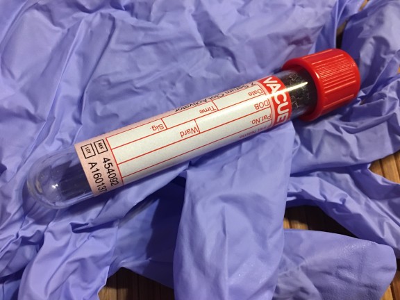 Vial of blood sitting on a blue rubber glove