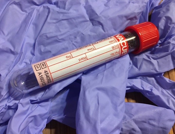 Vial of blood sitting on a blue rubber glove